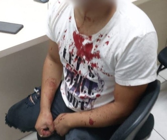 Trabalhador é agredido por supervisor e denuncia caso em Forquilhinha